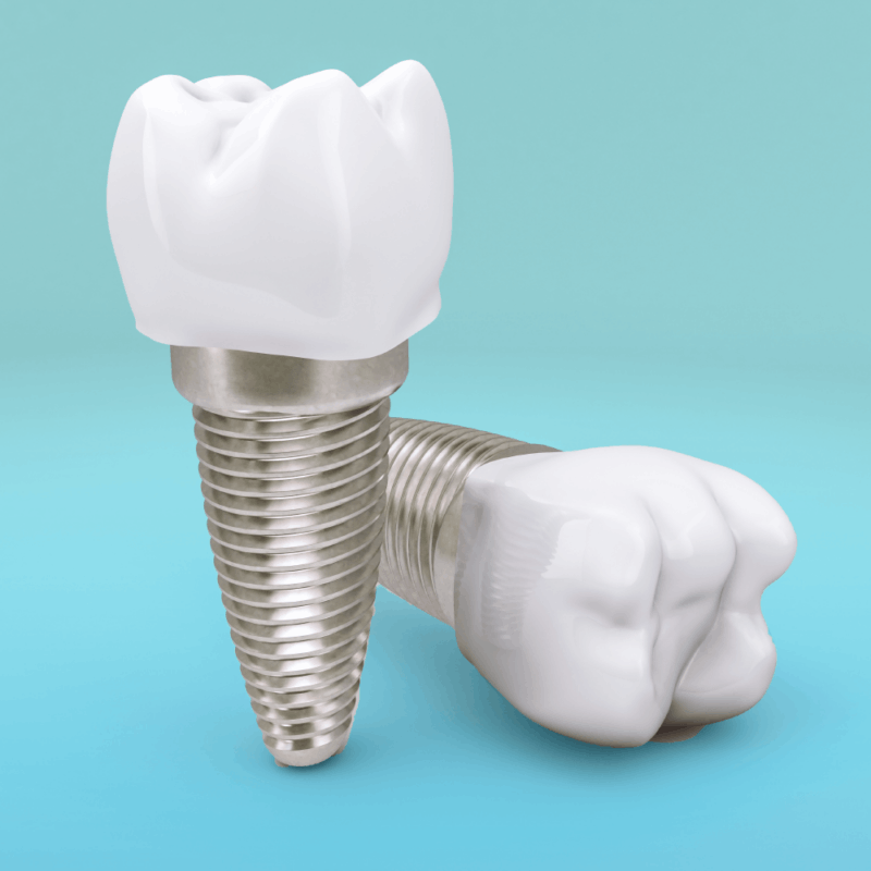 Dental Implants