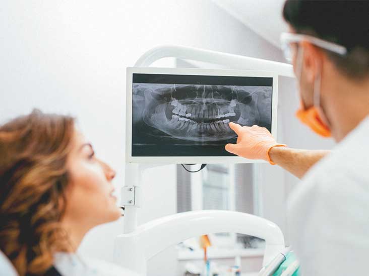 Dental X-rays