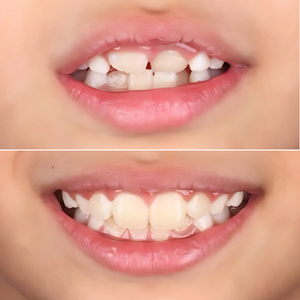 Kids Jaw & Airway Development