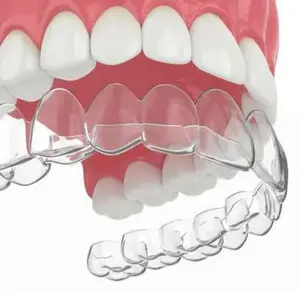 Invisalign