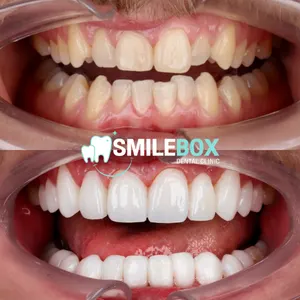 Full Digital Implant System