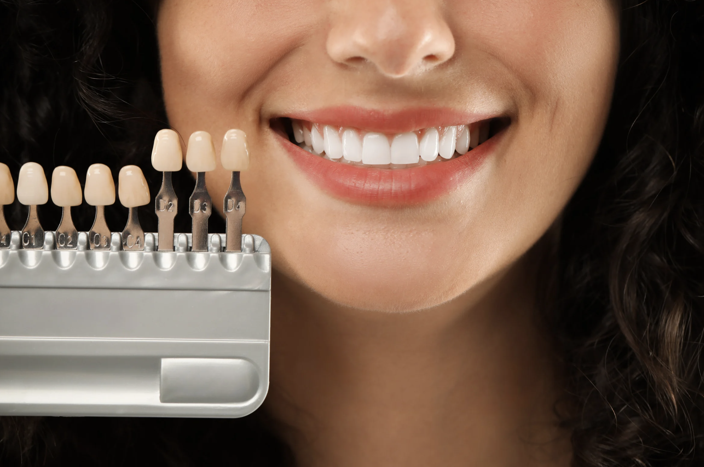 A woman color matching veneers for her teeth