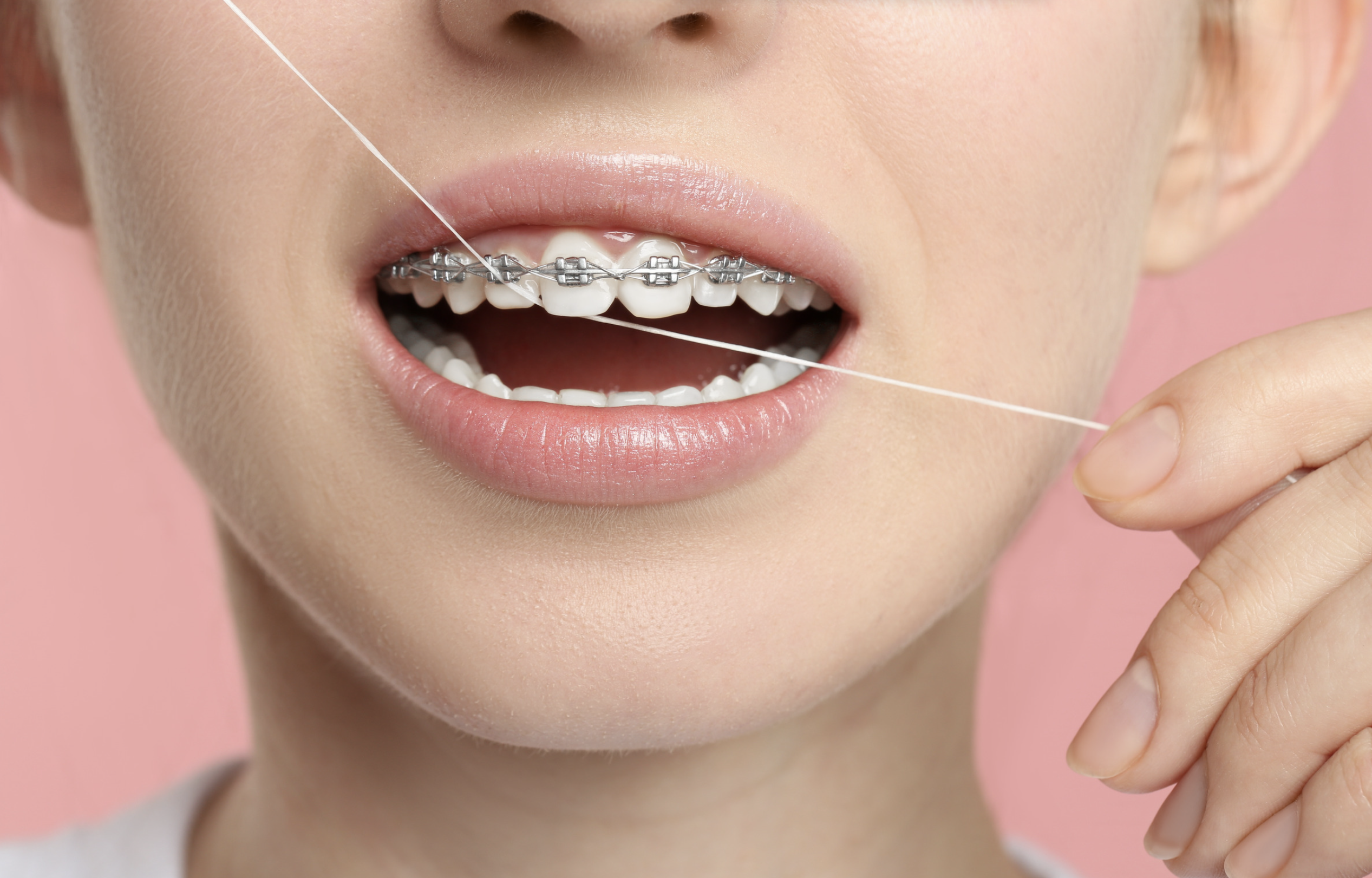A woman with braces using dental floss for oral health.