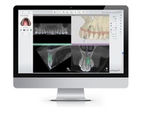 Full Digital Implant System